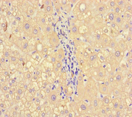 A2M Antibody