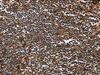 MAGEA3 Antibody