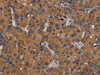 PDGFC Antibody