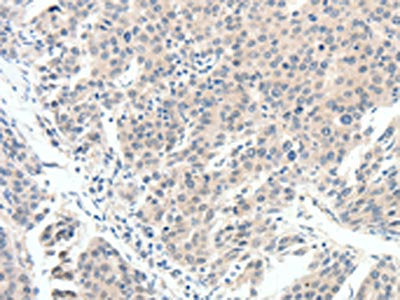 SCN10A Antibody