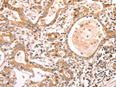 ABCF1 Antibody