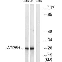 ATP5H Antibody