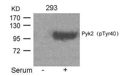 Phospho-PTK2B (Tyr402) Antibody