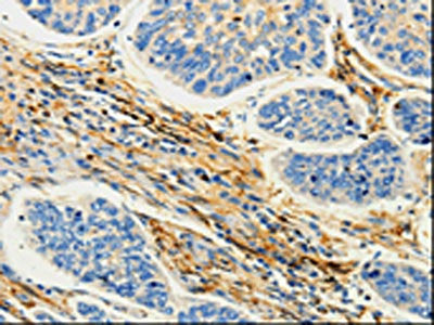 CAP1 Antibody