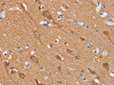 STMN1 Antibody