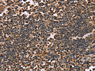 KLK14 Antibody