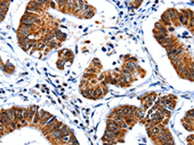 GSK3A Antibody