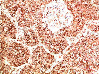 PTK2 Antibody