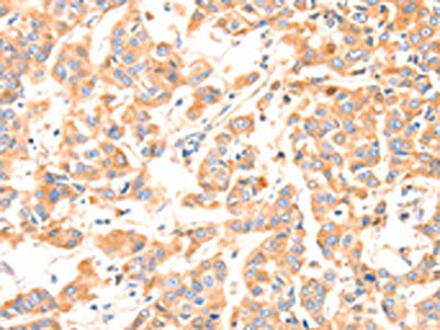 F13A1 Antibody