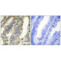 TNF Antibody