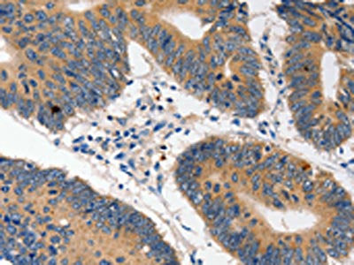 HDC Antibody