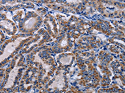 GNAS Antibody