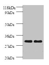 HLA-DPB1 Antibody