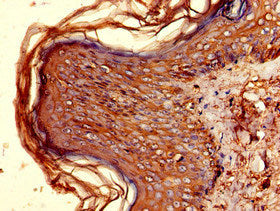HLA-DQB1 Antibody