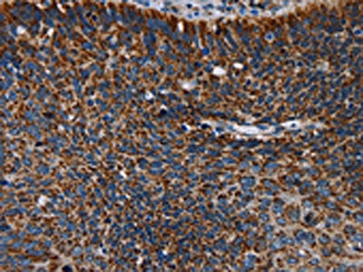 IDH2 Antibody
