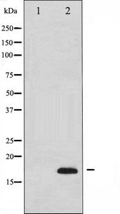 Cleaved-CASP3 (A175) Antibody
