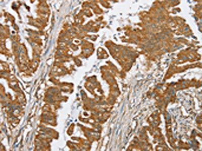 SERINC2 Antibody