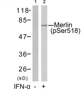 Phospho-NF2 (Ser518) Antibody