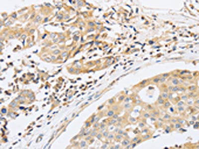 ABHD5 Antibody
