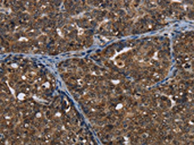 CERS6 Antibody