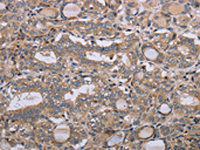 NAA25 Antibody