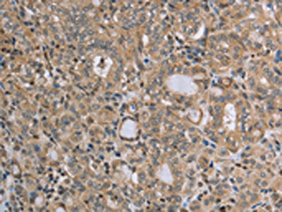RAB39B Antibody