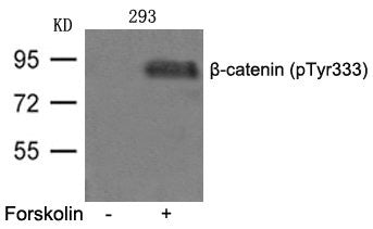 Phospho-CTNNB1 (Tyr333) Antibody