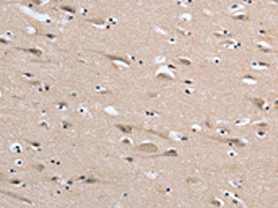 DLG2 Antibody