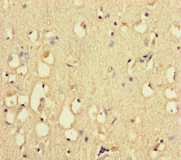 RYR2 Antibody