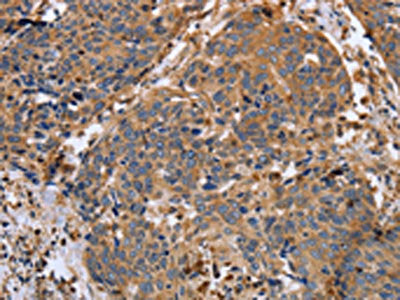 MMP9 Antibody