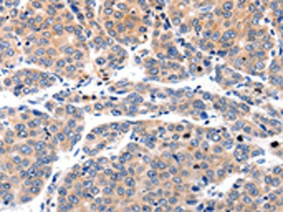 MYL9 Antibody