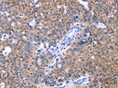 ZNF395 Antibody
