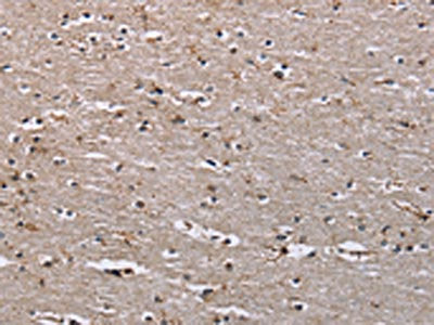 IQCJ Antibody