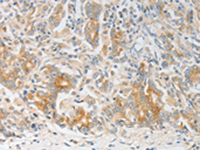 CALCR Antibody
