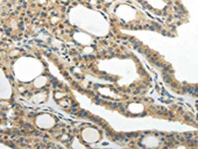 SMYD2 Antibody