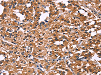 DKK4 Antibody