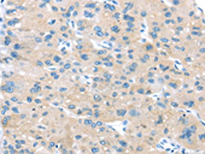 IGFBP3 Antibody