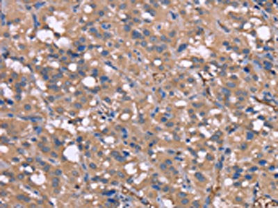 HP Antibody