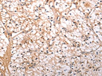 HCRTR1 Antibody
