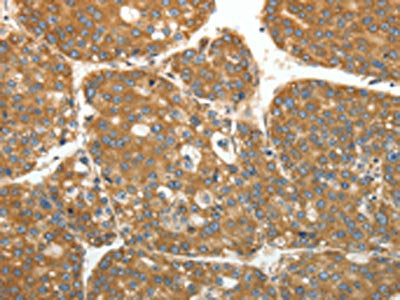 RPLP0 Antibody