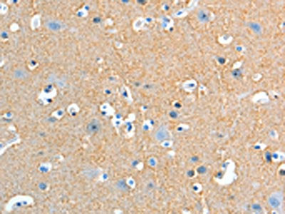ADD2 Antibody