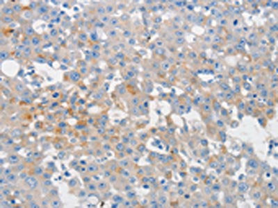 MUC5AC Antibody