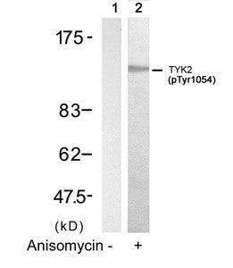Phospho-TYK2 (Tyr1054) Antibody