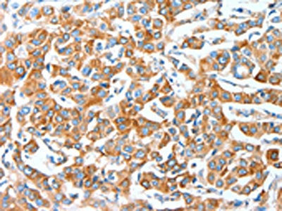 AFAP1 Antibody