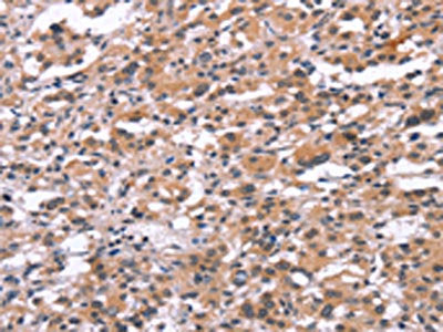 TUBGCP2 Antibody