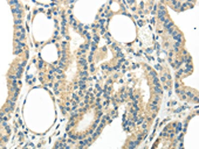 WNT6 Antibody