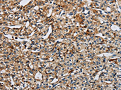 EIF2AK3 Antibody