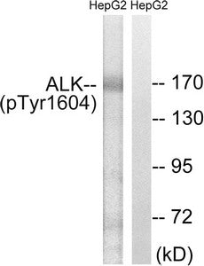 Phospho-ALK (Tyr1604) Antibody