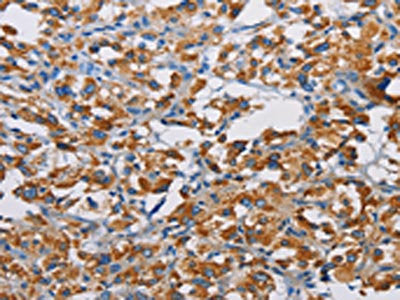 TSPEAR Antibody