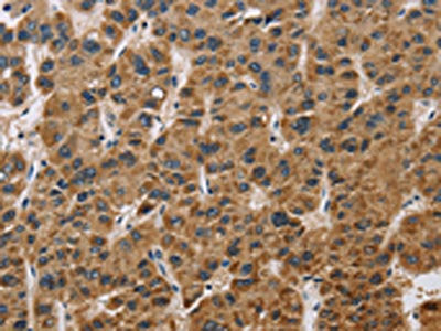 IL19 Antibody